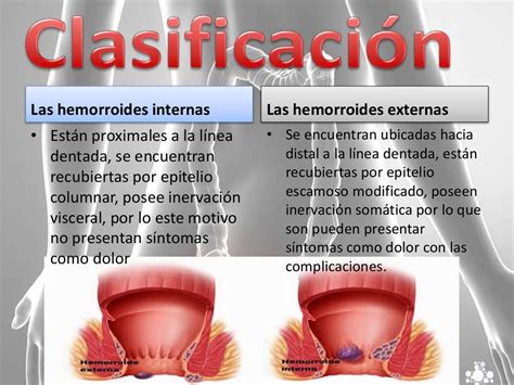 sexo anal y hemorroides|GUÍA SOBRE SALUD SEXUAL Y PATOLOGÍA。